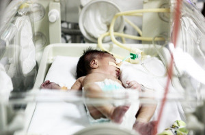 bebé reciennacido cunero neonatología 2