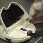 prueba diagnóstico paludismo