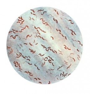 Vibrium cholerae. Imagen: Galería de los CDC