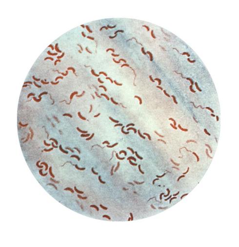 Vibrium cholerae. Imagen: Galería de los CDC