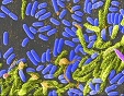 Científicos diseñan una vacuna contra el cólera de acción rápida que podría frenar los brotes