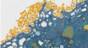 Imagen de partículas del coronavirus del MERS. Imagen: Science Photo Library