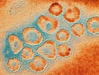 coronavirus imagen electrónica