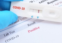 Infecciones Por Coronavirus Realizados Mas De 18 Mil Test
