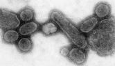 virus influenza 2018. Wikipedia Cynthia Goldsmith