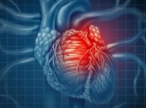 afecciones del corazón miocarditis