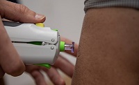 vacuna intradérmica sin aguja