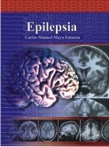 libro Epilepsia