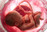 neonato feto