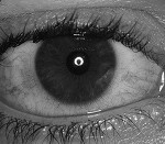 Síndrome de Sjögren ojo seco