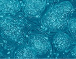 células embrionarias indiferenciadas