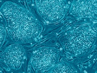 células madre indiferenciadas