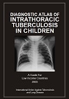 libro Dg Atlas of Intrathoracic TB in Children