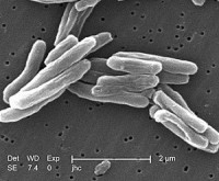 Mycobacterium tuberculosis