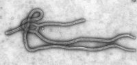 micrografía electrónica del virus del ébola