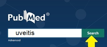 pubmed uveitis