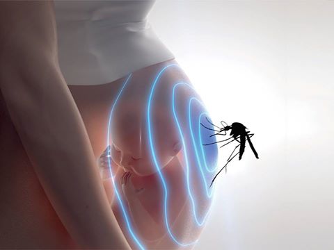 Embarazo y Zika. Fuente: CDC